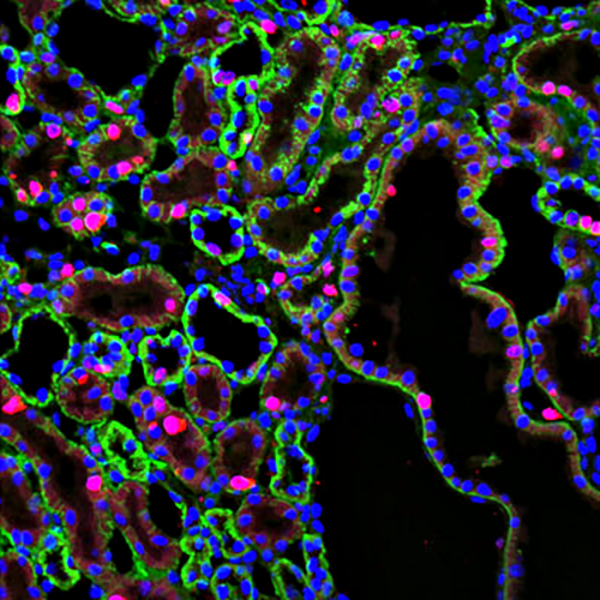 Immunofluorescent image of renal tubular epithelial cells from a mouse labeled with DSHB antibody a5 against ATPase, Na+K+ alpha subunit (green). PMID: 36997516, Fig. 3F.